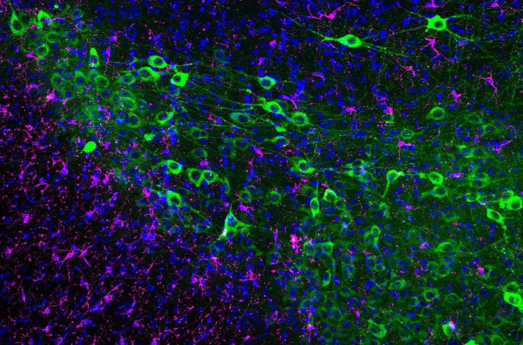 Immuntherapie könnte Neuronenverlust bei Parkinson stoppen