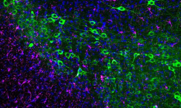 Immuntherapie könnte Neuronenverlust bei Parkinson stoppen