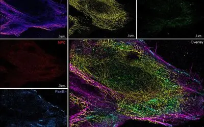 Mikrofluidik-System für zuverlässigere Superauflösungsmikroskopie von Zellen entwickelt