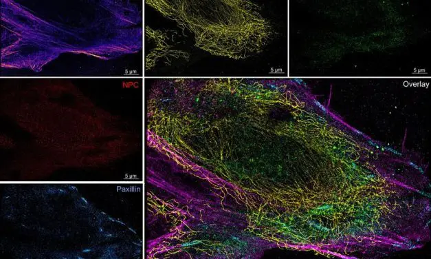 Mikrofluidik-System für zuverlässigere Superauflösungsmikroskopie von Zellen entwickelt