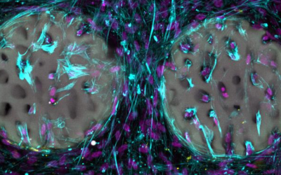 Laser-strukturiertes Hydrogel als vielversprechendes Knochenimplantat