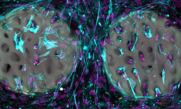 Laser-strukturiertes Hydrogel als vielversprechendes Knochenimplantat