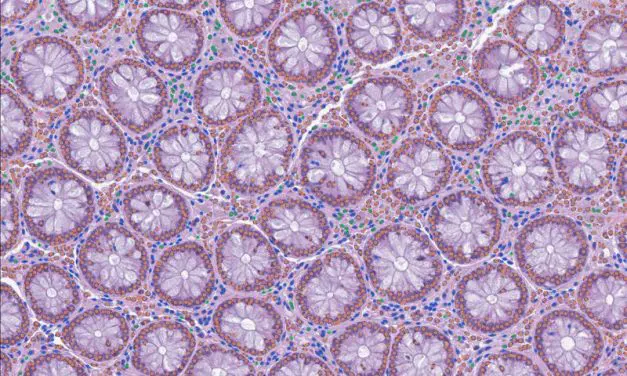 Open-Source-Tool LazySlide erleichtert KI-Analyse von Gewebebildern