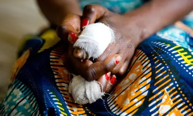 KI-basierte Smartphone-App zur Früherkennung vernachlässigter tropischer Hautkrankheiten