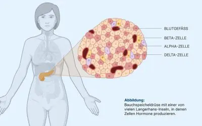 Erklärbare KI enthüllt versteckte Gewebeveränderungen bei Typ-2-Diabetes