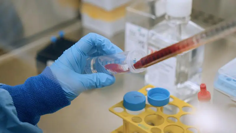 Blutproben von Heptatitis-C-Patient*innen wurden im Labor untersucht und so entscheidende Veränderungen festgestellt. | Copyright: Universitätsklinikum Freiburg