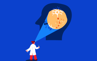 NfL-Bluttest zum Nachweis von Neuroinflammation bei MS erhält CE-Kennzeichnung