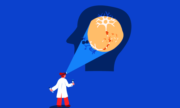 NfL-Bluttest zum Nachweis von Neuroinflammation bei MS erhält CE-Kennzeichnung