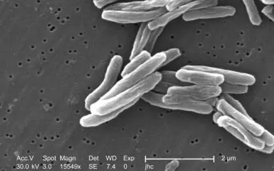 Langfristige Heilungschancen bei multiresistenter Tuberkulose deutlich höher als gedacht