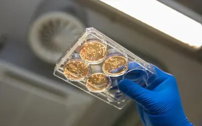 MHH entwickelt Bioreaktoren für millionenfache Produktion menschlicher Makrophagen