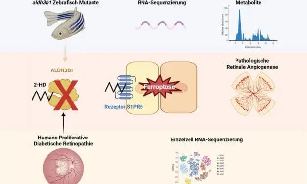 Neuer Mechanismus der krankhaften Gefäßneubildung im diabetischen Auge entdeckt