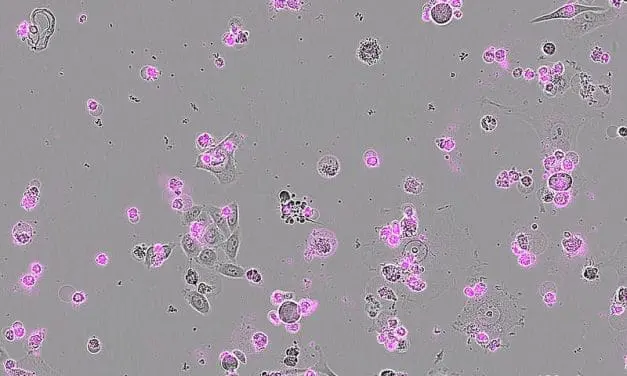 Neue CRISPR-Technologie mit Cas12a2 ermöglicht gezielte Abtötung unerwünschter Zellen