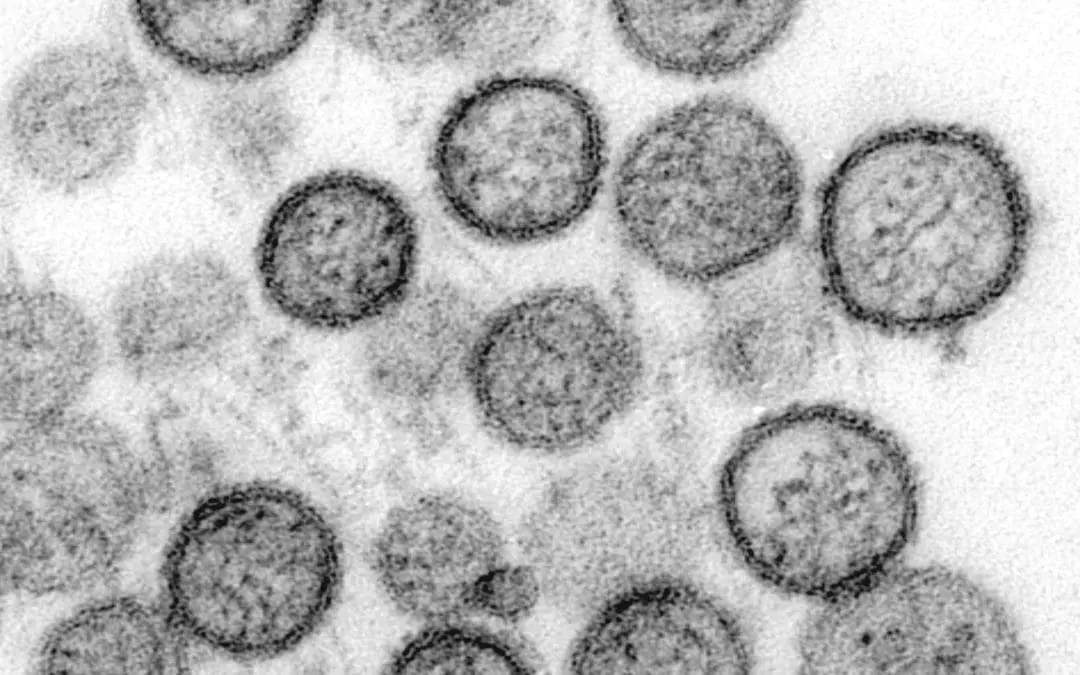 Hantavirus aktuell: Nachweis, Symptome, Therapie