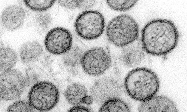 Hantavirus aktuell: Nachweis, Symptome, Therapie