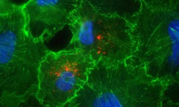 Hantavirus: Experten der Universitätsmedizin Essen sehen geringes Risiko für die Allgemeinbevölkerung