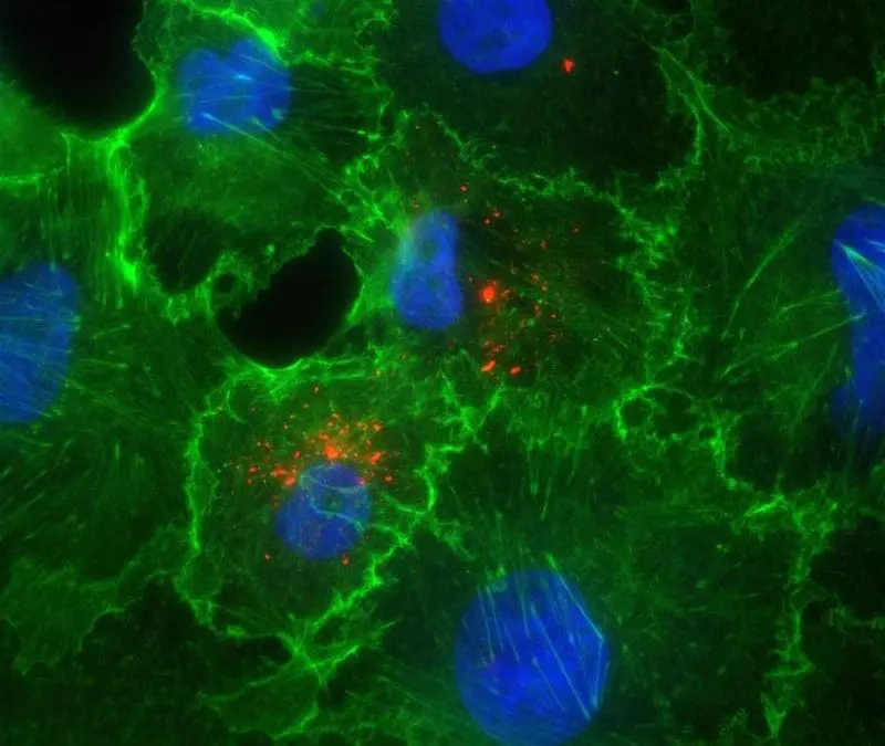 Hantavirus: Experten der Universitätsmedizin Essen sehen geringes Risiko für die Allgemeinbevölkerung