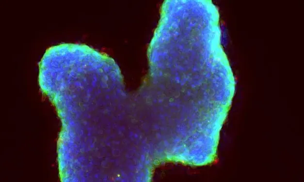 CHEM-SCAN soll Chemoresistenz bei Tumoren sichtbar machen