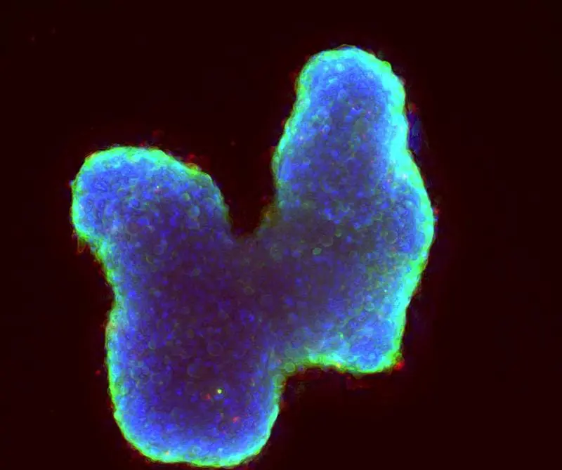 Mikroskopaufnahme eines in der Kulturschale gezüchteten Tumormodells: Das Projekt nutzt solche Zellkulturen für seine Analysen. Die fluoreszierenden Farben markieren bestimmte Zellbestandteile. Maßstab: 150 Mikrometer. | Quelle: Universität Bielefeld | Copyright: Universität Bielefeld