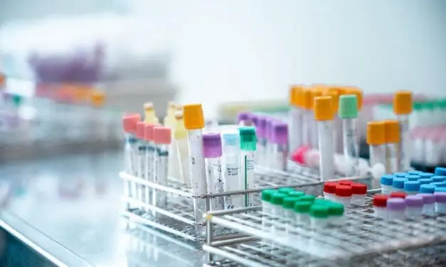 Erhöhte Glukagonspiegel bei Typ-2-Diabetes bereits früh nach Diagnose nachweisbar