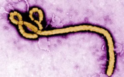 Ebola-Ausbruch: Kein Impfstoff, Begrenzte Diagnostikmöglichkeiten