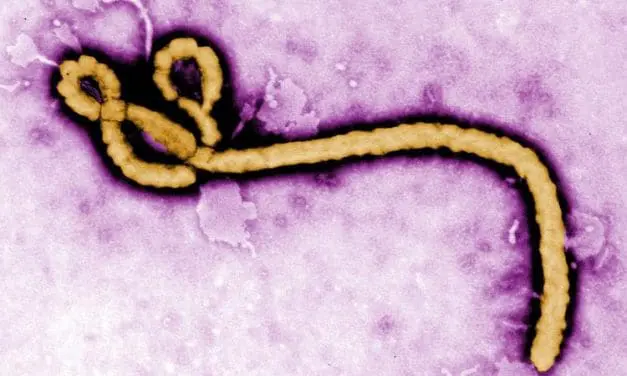 Ebola-Ausbruch: Kein Impfstoff, Begrenzte Diagnostikmöglichkeiten