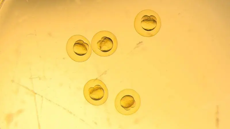 Fünf Zebrafisch-Embryos im Wassertropfen. Deutlich zu sehen ist der Eidotter, auf dessen Spitze sich die ersten zwei Zellen befinden. ISTA Forschende beobachtn hier Epibolie: „Man kann sich das wie eine Mütze vorstellen, die man sich über den Kopf zieht." | Copyright: © ISTA