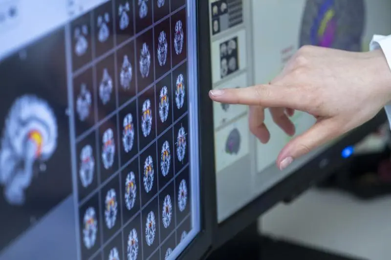 Auswertung der mittels fMRT aufgenommenen Gehirnscans (Symbolbild) | Quelle: David Ausserhofer | Copyright: DIfE