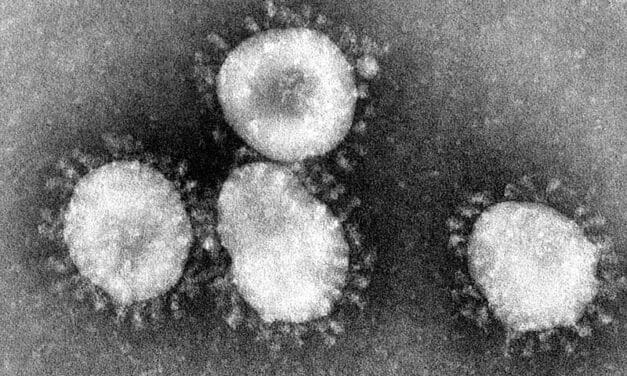 HPC-Hochleistungsrechner entdecken 13 unbekannte Coronaviren