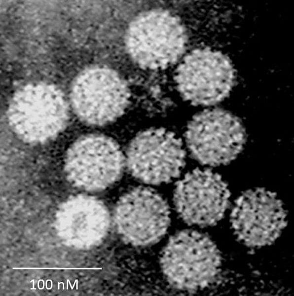 Human papillomavirus (HPV). Credits: Dr Graham Beards/Wikipedia