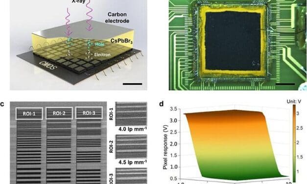 Perowskit-Röntgendetektor soll die medizinische Bildgebung verbessern
