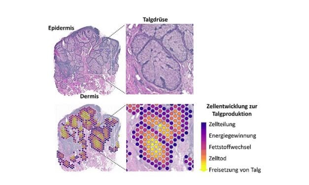 Neue Methode ermöglicht molekulares Porträt der Talgproduktion