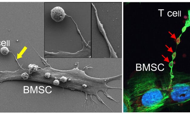 Mitochondrientransfer stärkt Krebsimmuntherapie