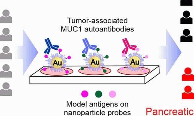 Bauchspeicheldrüsenkrebs: Glykopeptid-Sonden detektieren Tumor-assoziierte Autoantikörper in Blutproben