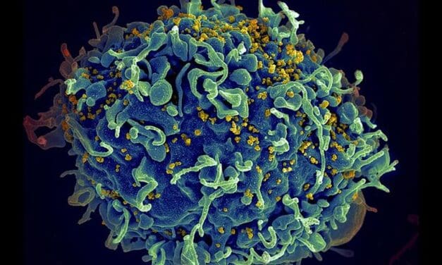 Neuer Labortest zum Nachweis persistenter HIV-Stämme in Afrika