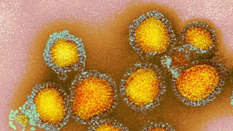 Electron micrograph of influenza viruses | Copyright: CDC/Science Photo Library  