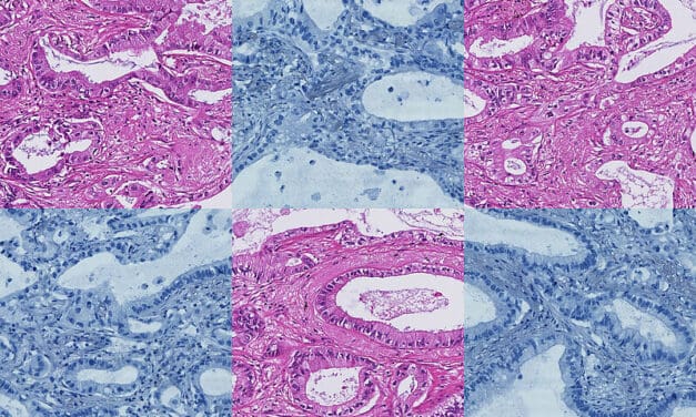 Schlauer als ChatGPT: MEVIS Forschende entwickeln Basismodell für Biomarker-Erkennung