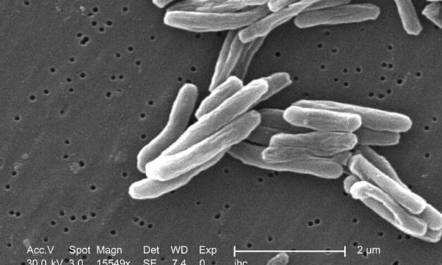 Biomarker zur Vorhersage von Nebenwirkungen der Tuberkulosetherapie