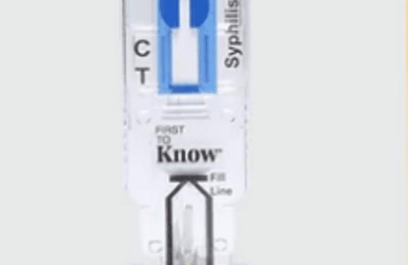 FDA genehmigt ersten OTC Syphilis-Heimtest der USA