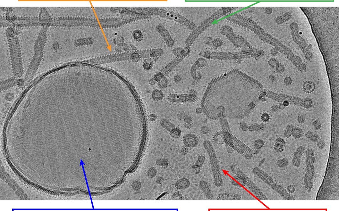 Kryo-Elektronenmikroskopie gibt neue Einblicke in Reparatursystem der Zellmembran