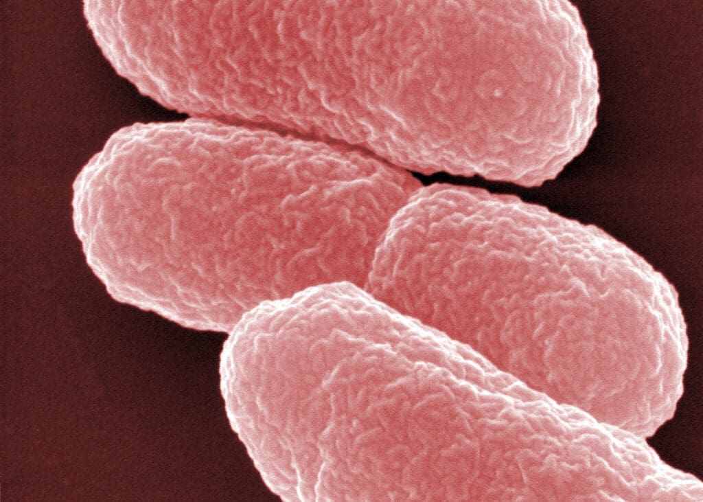 Elektronenmikroskopische Aufnahme von Escherichia coli (Copyright: HZI/Manfred Rohde)