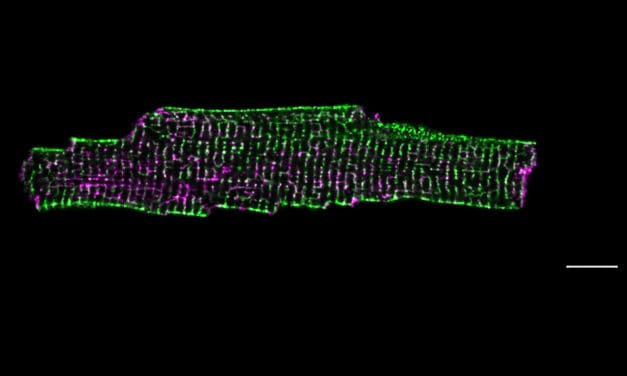 Herzschwäche: Protein Dysferlin schützt und formt die Membran von Herzmuskelzellen