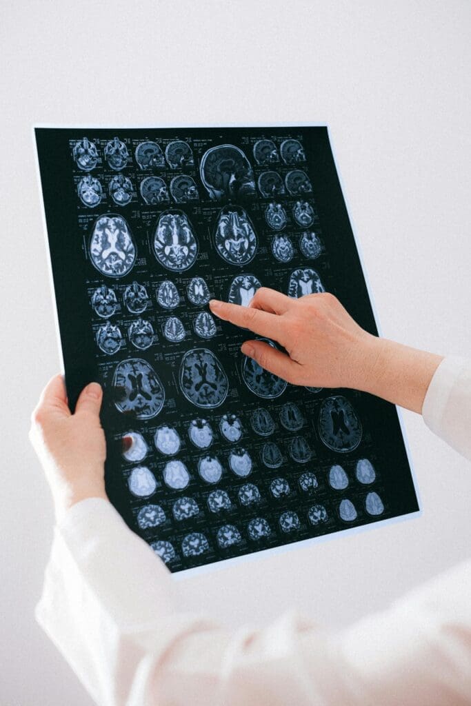 Brain. Symbolic image. Credits: Pexels