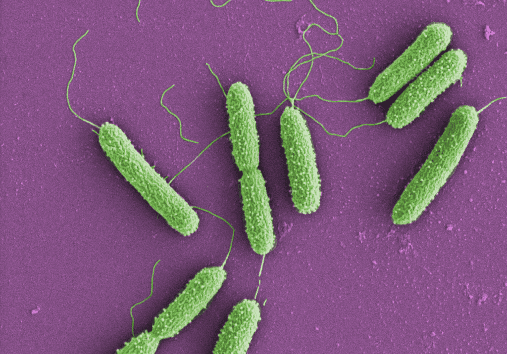 The bacterium Pseudomonas aeruginosa is resistant to many antibiotics and can lead to severe pneumonia, urinary tract infections or sepsis. Picture: Empa 