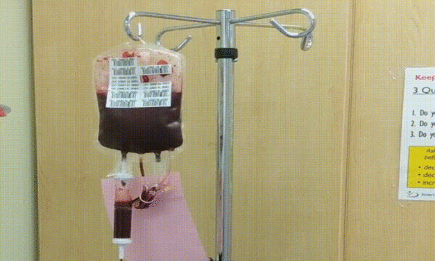 Neuer Blutgruppentyp AnWj-negativ: Afrika bleibt bei Umsetzung von Tests zurück