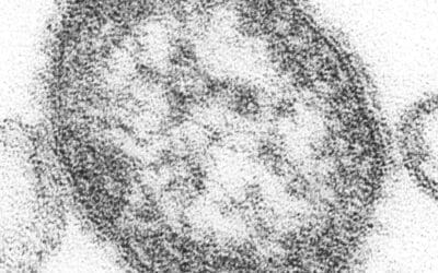 Masern: Impflücken bei Kleinkindern alarmieren Krankenkassen