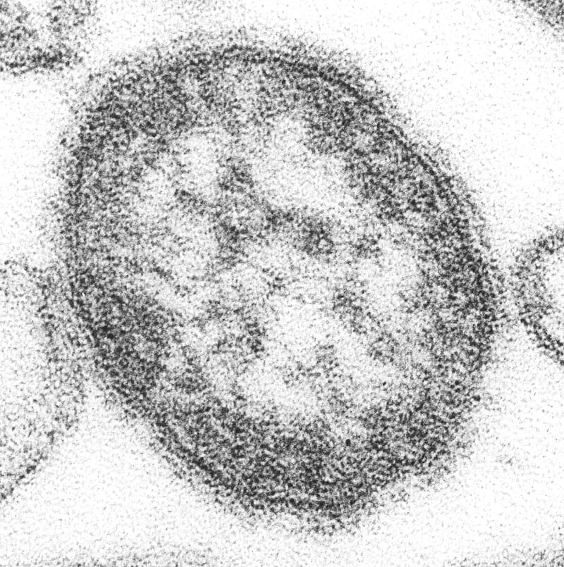 Credits: CDC/ Courtesy of Cynthia S. Goldsmith; William Bellini, Ph.D