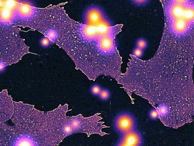 Artist's impression of individually dissolved glycans in front of whole cells. | Copyright: Guadalupe Arribas