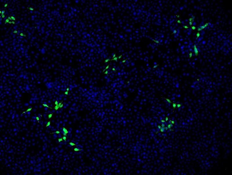 Mit HEV infizierte Nierenzellen sind mit einem grünen Fluoreszenzfarbstoff markiert. Nicht infizierte Zellen sind blau angefärbt. | Copyright: © TWINCORE