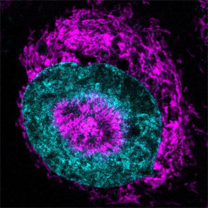The inside of a squashed cancer cell, in which the mitochondria (pink) accumulate on the outside of the cell nucleus (cyan) and in "wells" of the cell nucleus. | Source: Rito Ghose &amp; Fabio Pezzano | Copyright: Centro de Regulación Genómica 