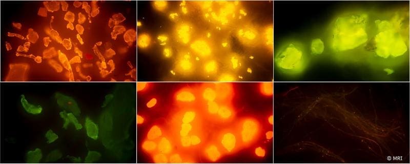 Fluorescence image with microplastics | Copyright: Max Rubner-Institut